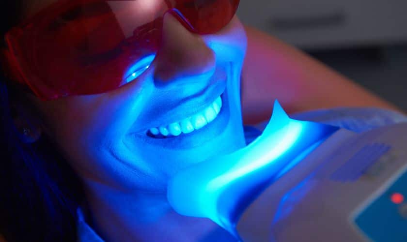 Teeth Whitening Dentist near Me  : Discover the Secrets for a Dazzling Smile
