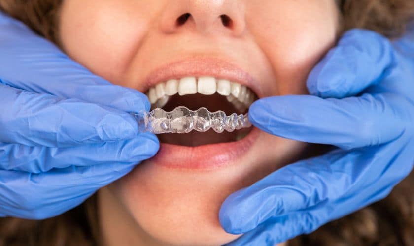 Invisalign: The Clear Path to a Straighter Smile in Tulsa