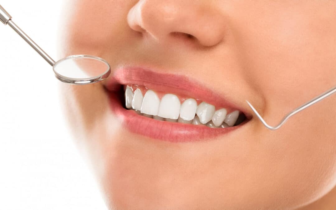 5 Things to Avoid After Whitening Your Teeth
