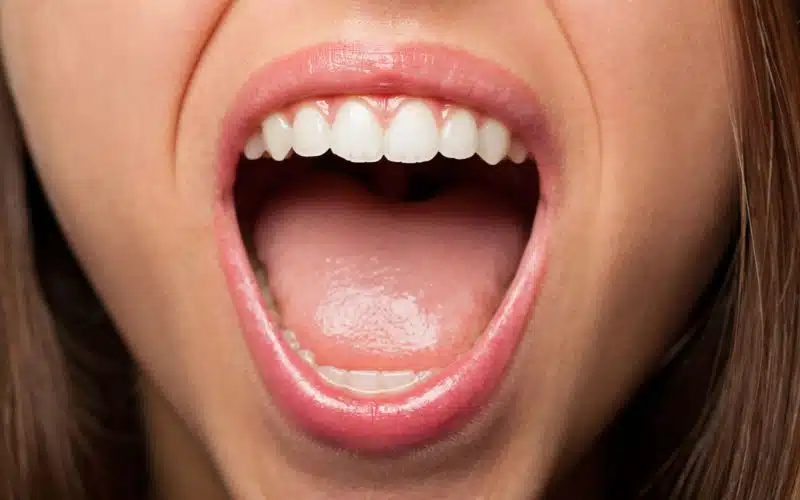 Tips to Prevent and Manage Bumps on Your Tongue