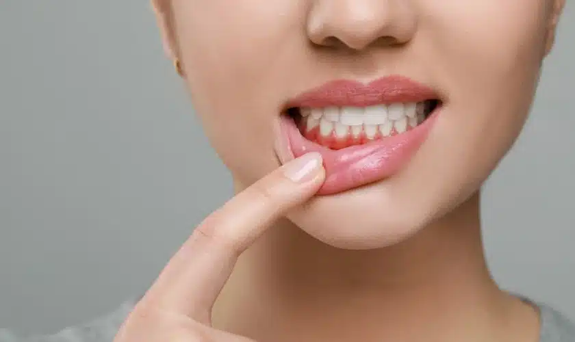 5 Shocking Facts About Gum Disease That Might Surprise You
